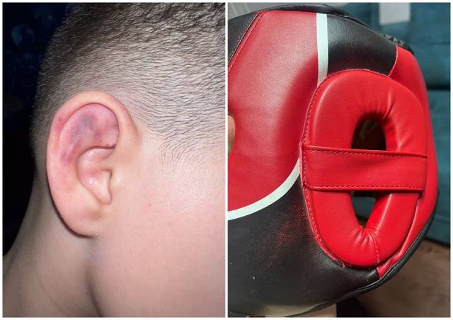 Глава СК Бастрыкин поручил доложить о результатах проверки из-за травмирования ребенка в секции по боксу