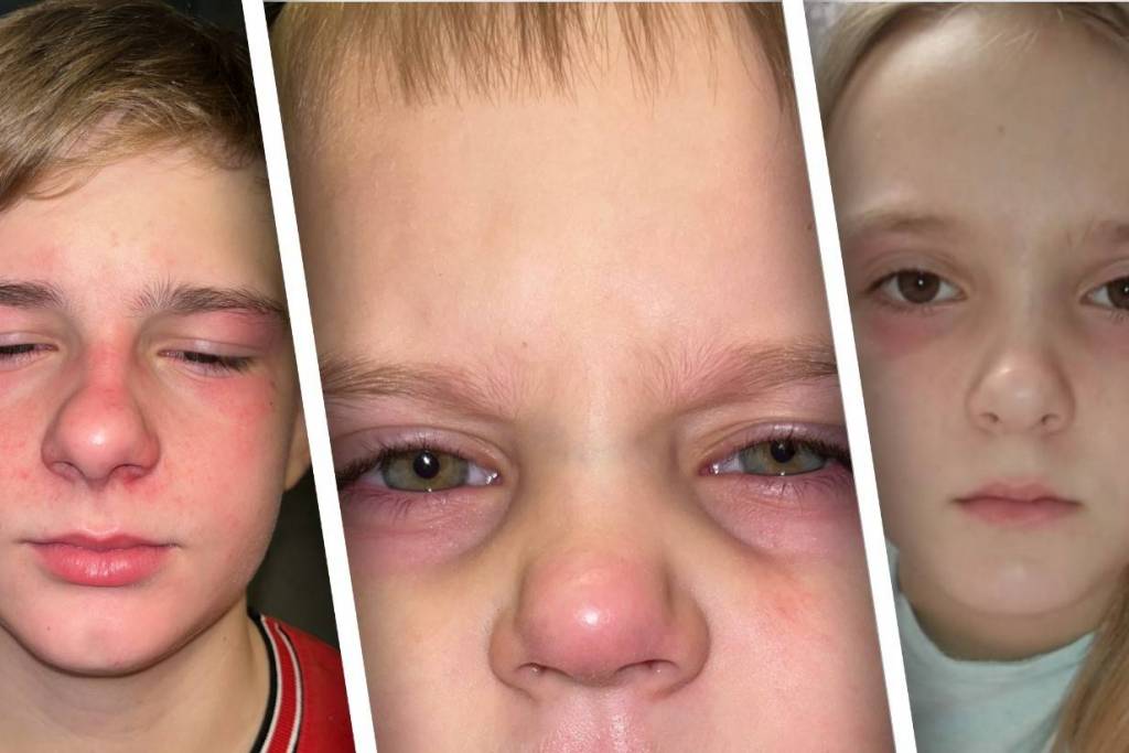 «Ребятишки плакали»: в Новосибирске шестеро детей оказались в больнице с отравлением хлором после бани