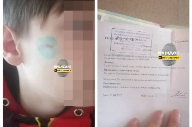 Неизвестный мужчина жестко избил мальчика в Новосибирске