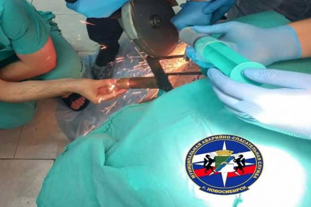 В Новосибирске через голову мужчины прошли вилы: ему помогли спасатели