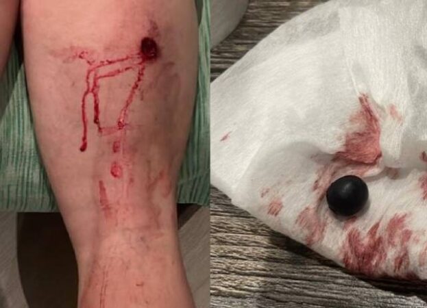 «Поехали в лес