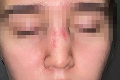 В Новосибирске мужчина избил школьницу и сломал ей нос за замечание о выгуле собаки