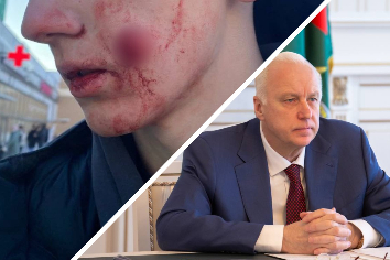 Бастрыкин возмутился стрельбой в новосибирского подростка