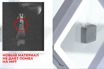 В Новосибирске создали первый карбидный композит для протезирования