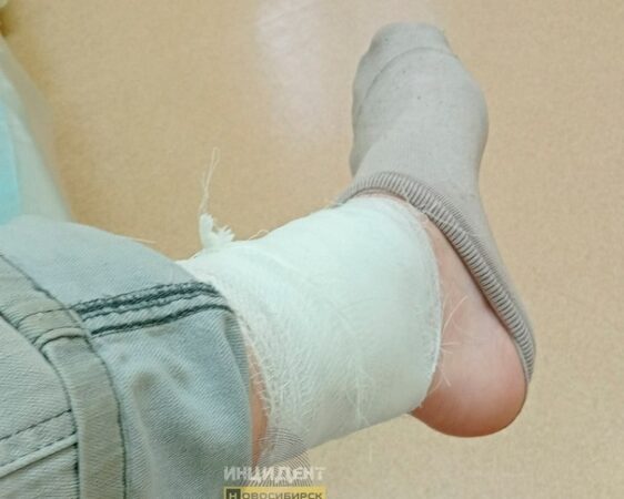 В Новосибирске рабочего на стройплощадке покусали бездомные собаки