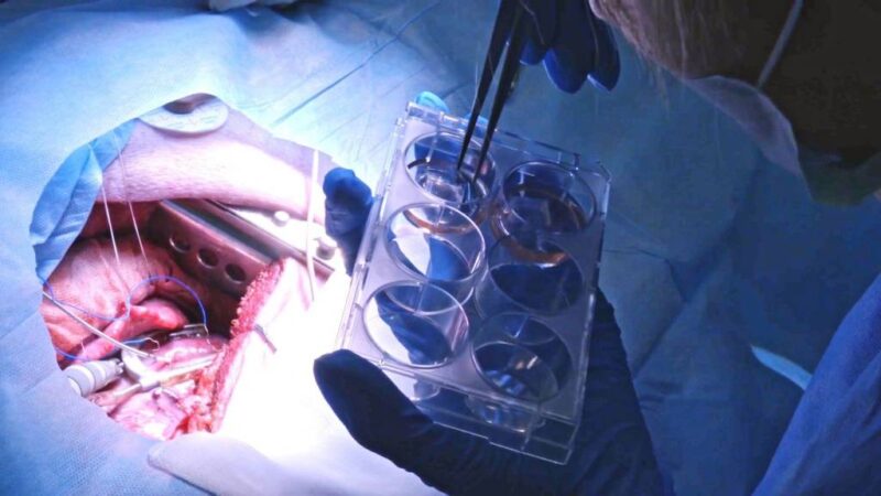 Ученые Новосибирска провели уникальную операцию на сердце свиньи