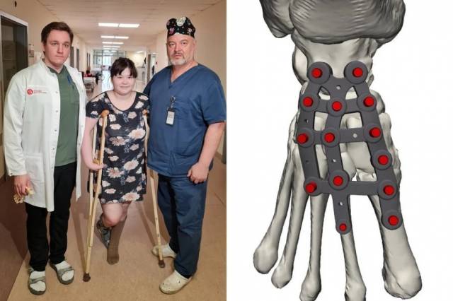 В Новосибирске девочке-подростку установили 3D-имплант на искривленную стопу