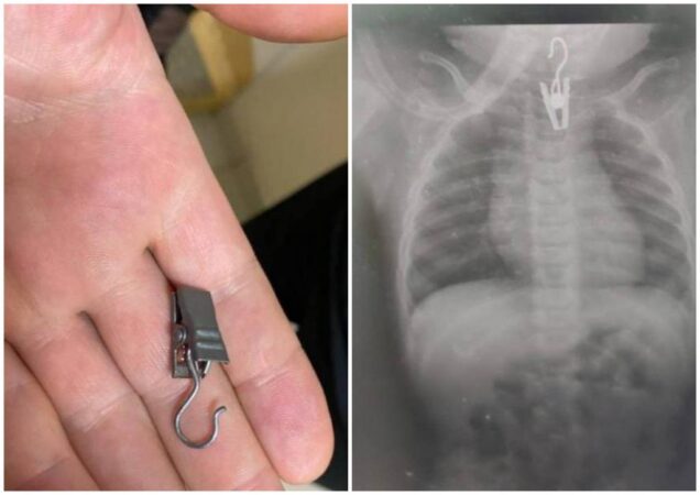 В Новосибирске медики спасли 6-месячного ребенка