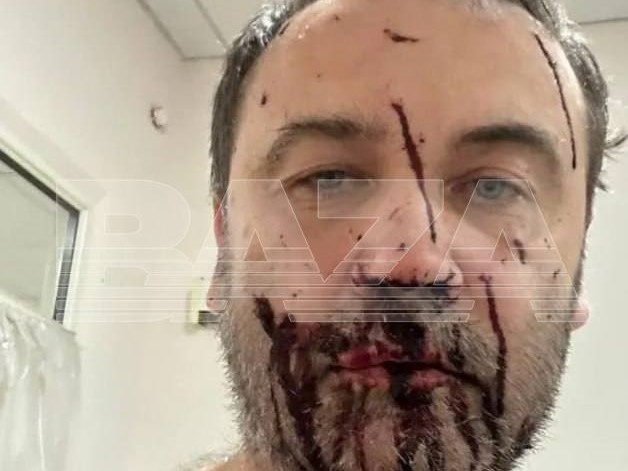 Экс-депутат Госдумы от Новосибирской области Пономарев* пострадал в результате атаки БПЛА на его дом под Киевом