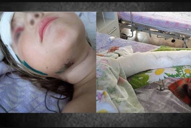 Мать сбитой новосибирским участковым девочки рассказала о ее состоянии