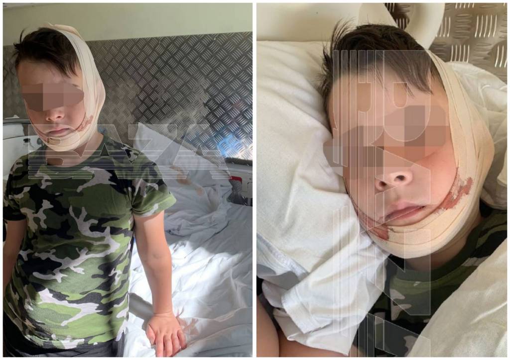 Полицейский из Новосибирска на самокате сбил ребенка в Санкт-Петербурге